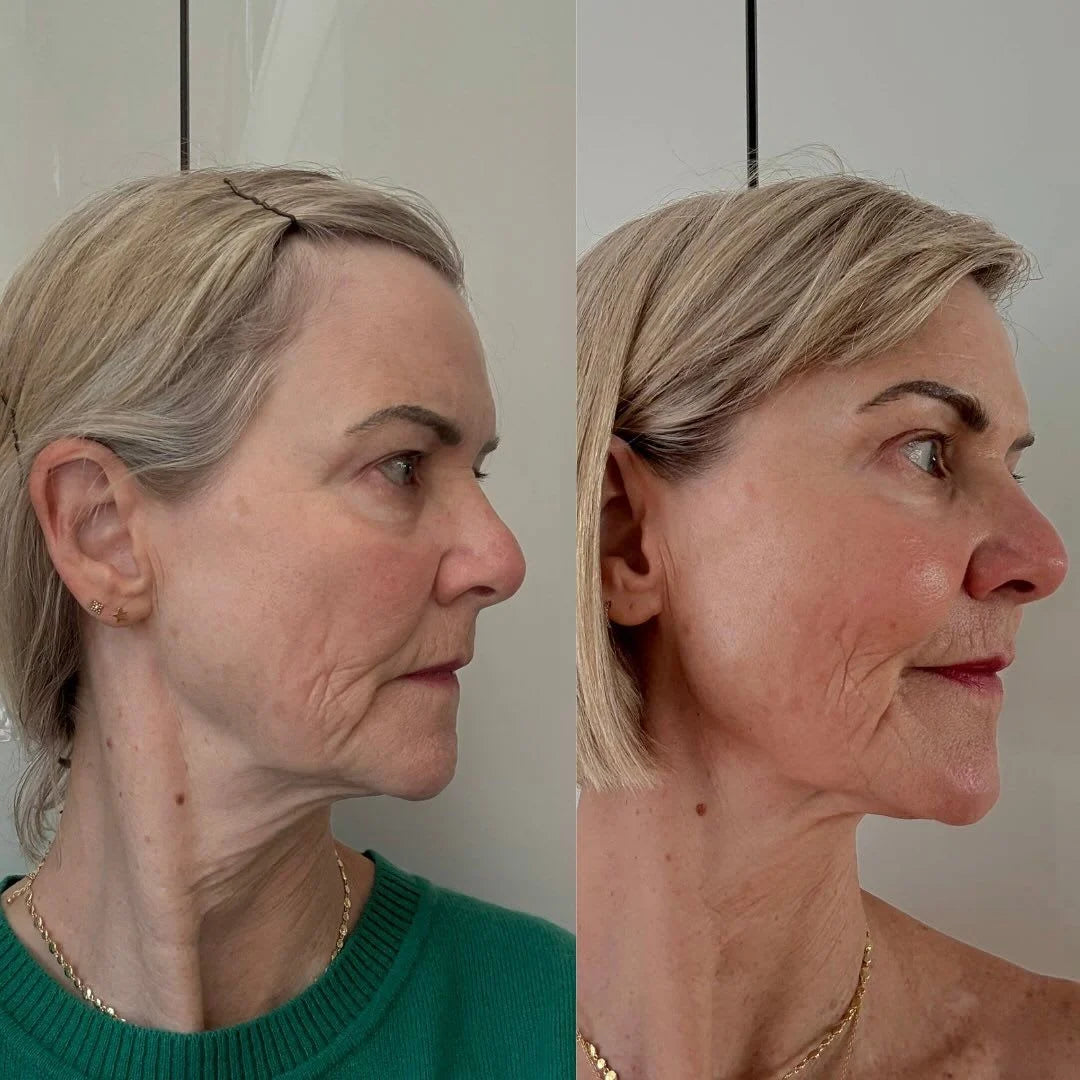Gua Sha Lift-Sculpting Gel Cream
