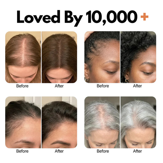 The Korea #1 Hair Density Serum