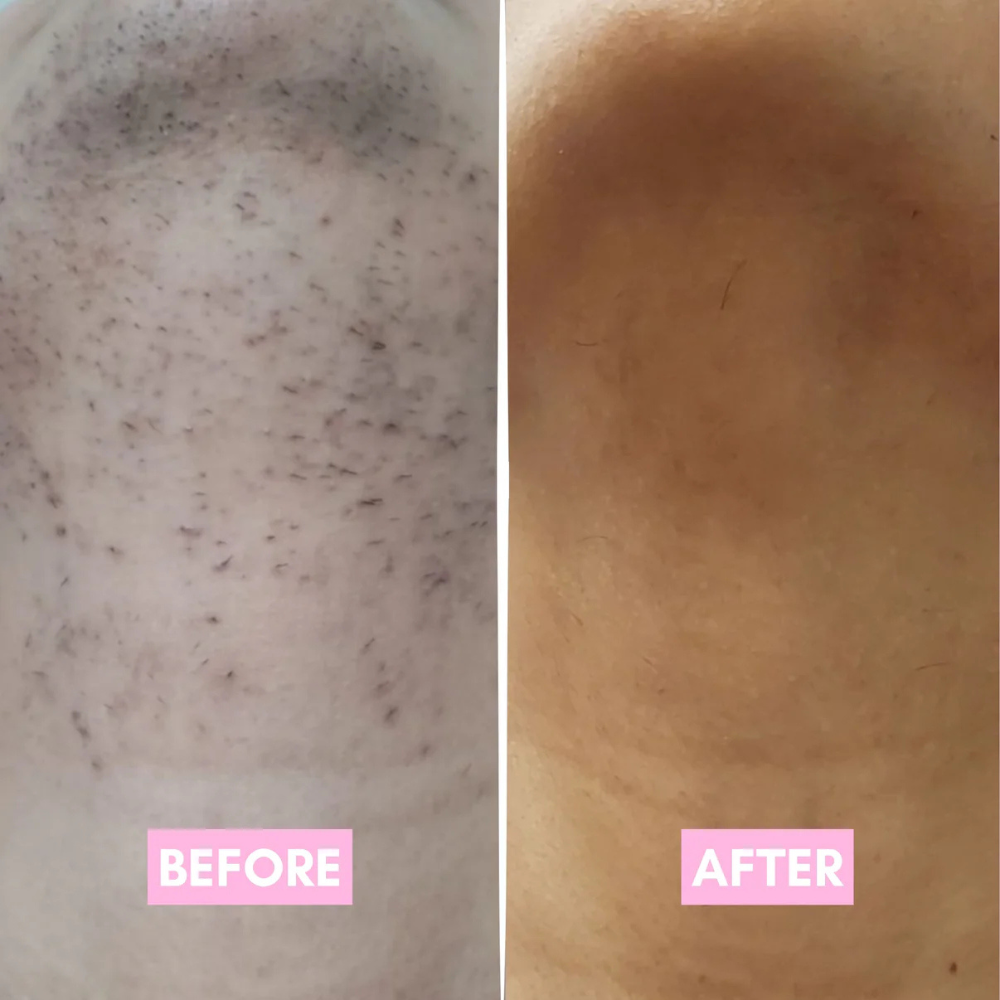 The Korean Smooth Skin Secret