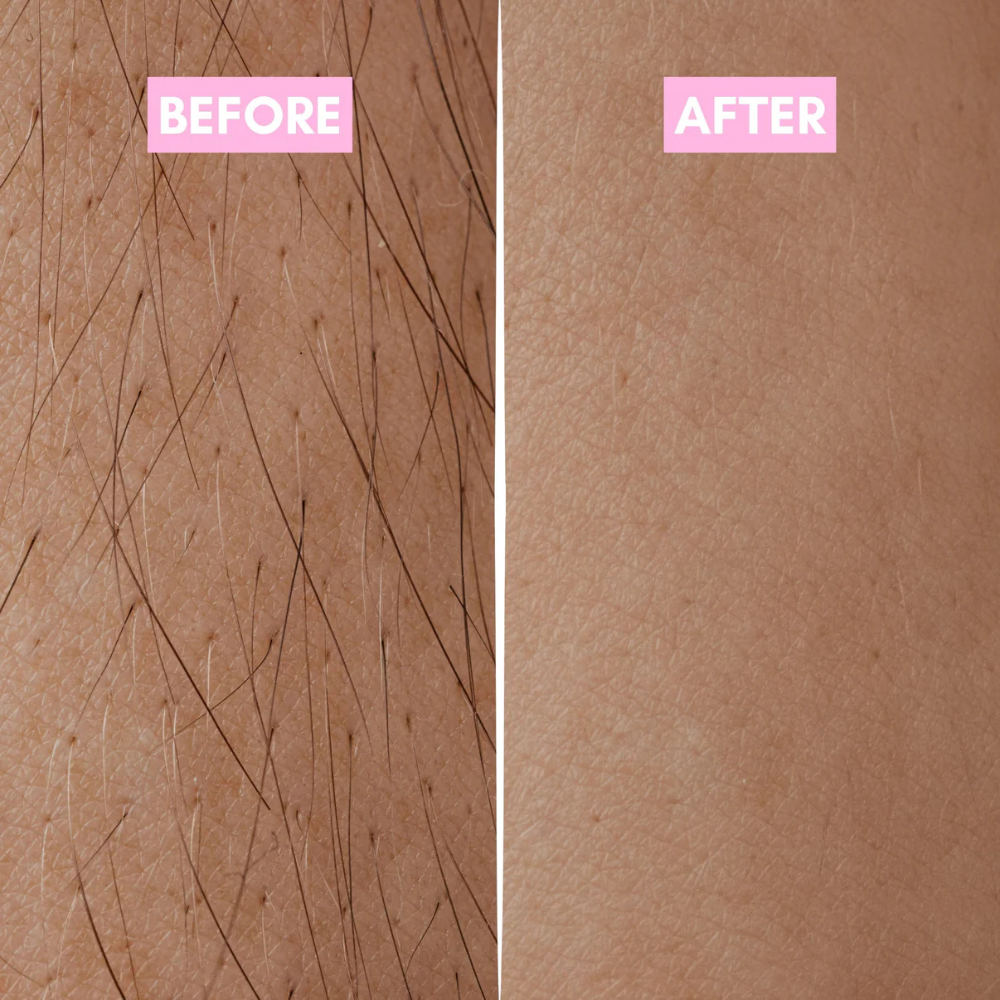 The Korean Smooth Skin Secret