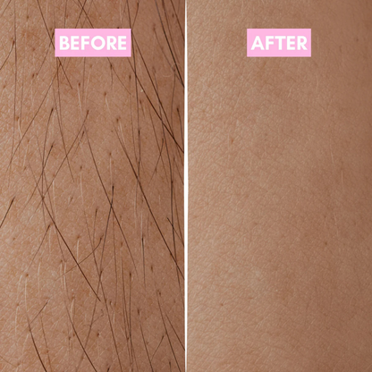 The Korean Smooth Skin Secret
