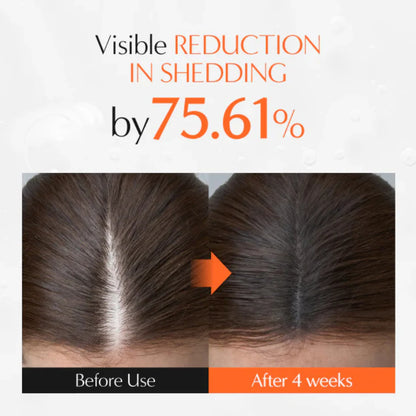 The Korea #1 Hair Density Serum