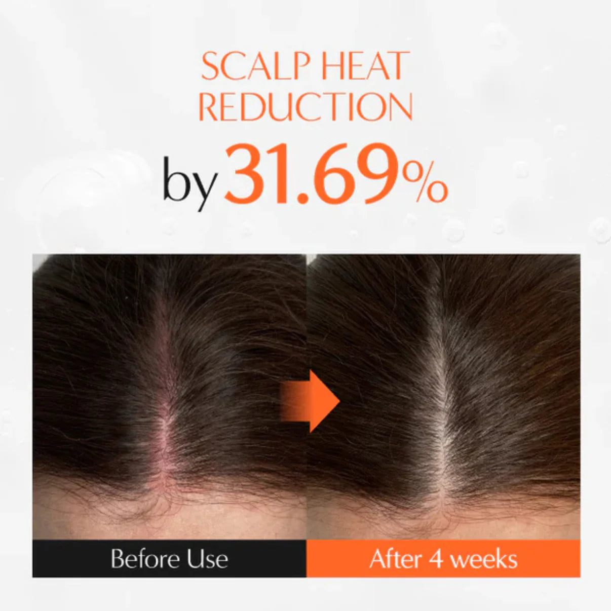 The Korea #1 Hair Density Serum