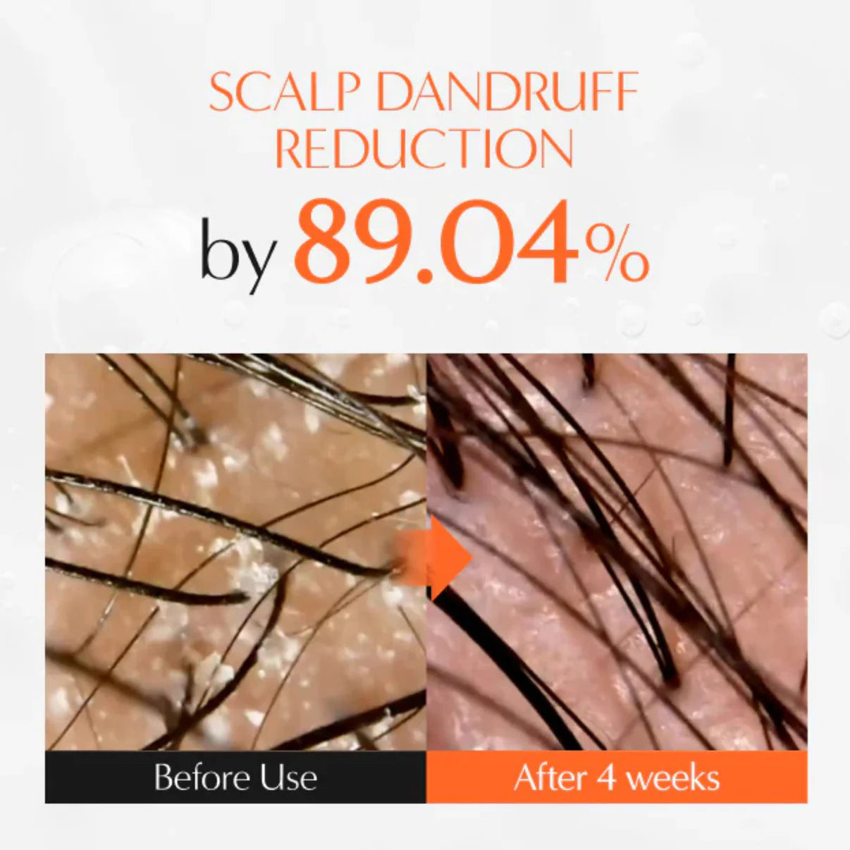 The Korea #1 Hair Density Serum