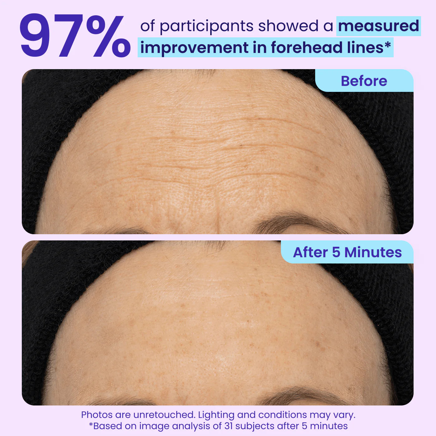 Instant Lift Eye Gel