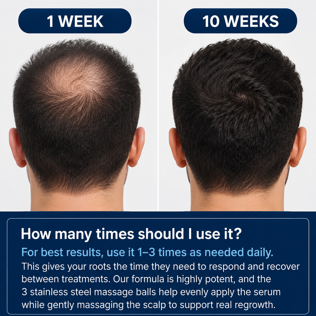 Deoxyribose Scalp Serum