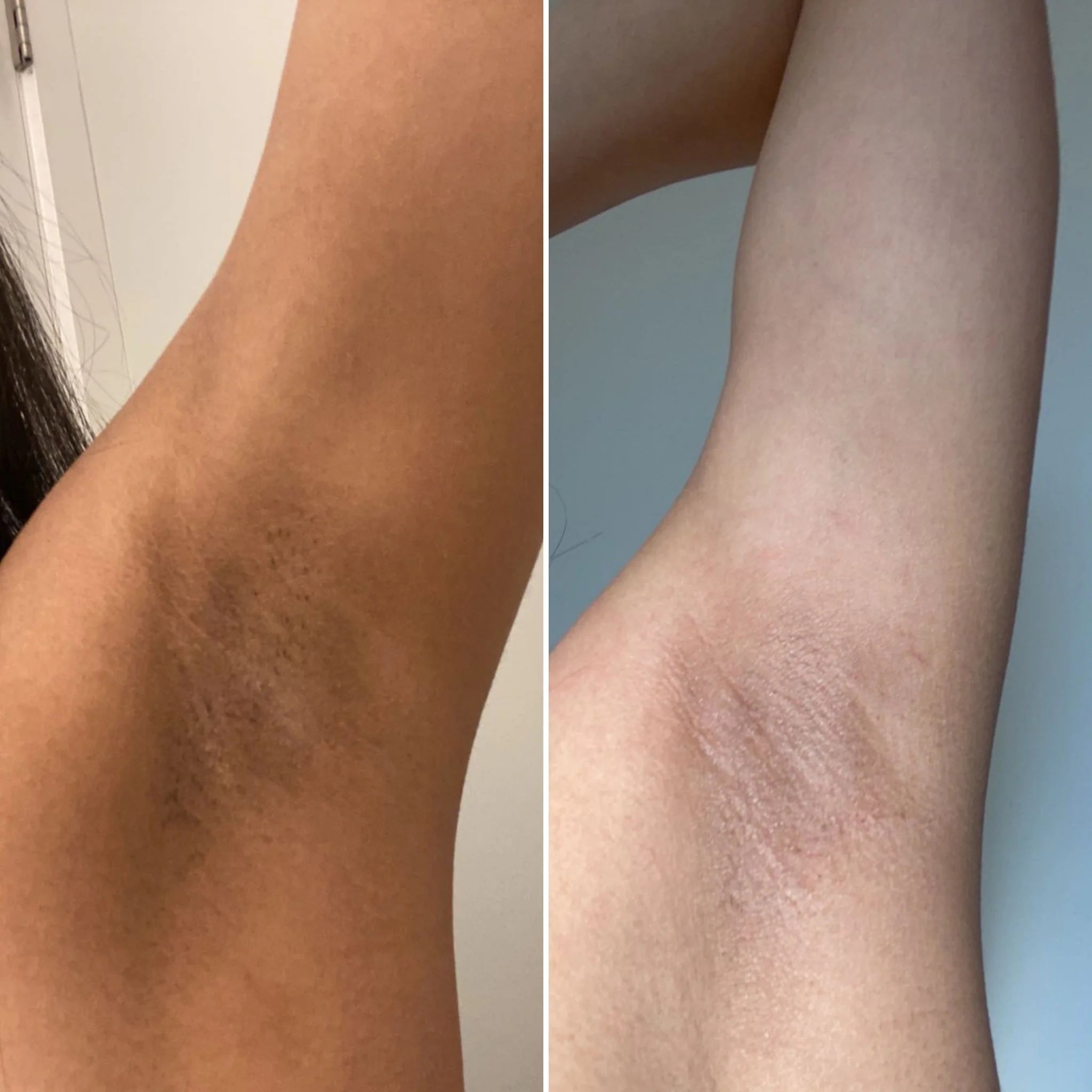 Lauren resultado