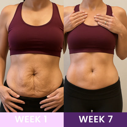 Fajas Colombianas Waist Trainer | Lose Inches in Weeks