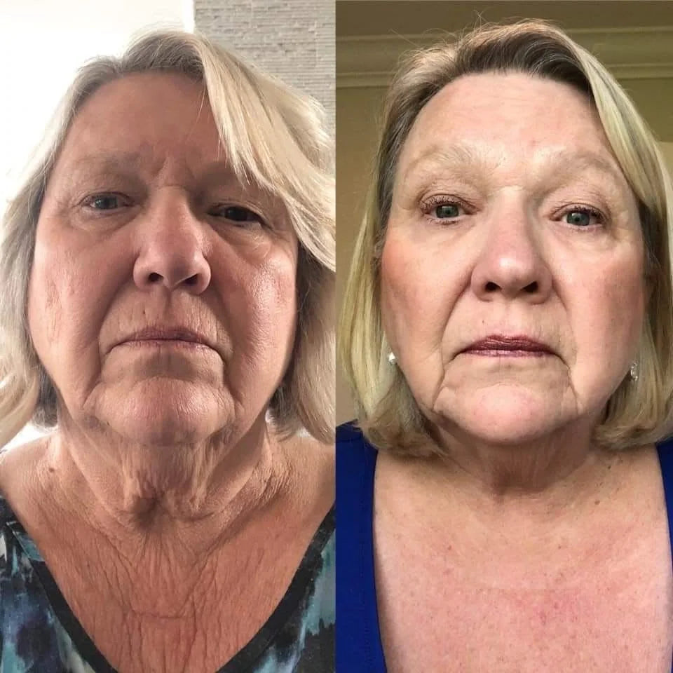 Collagen Retinol Refining Guasha Lifting Cream
