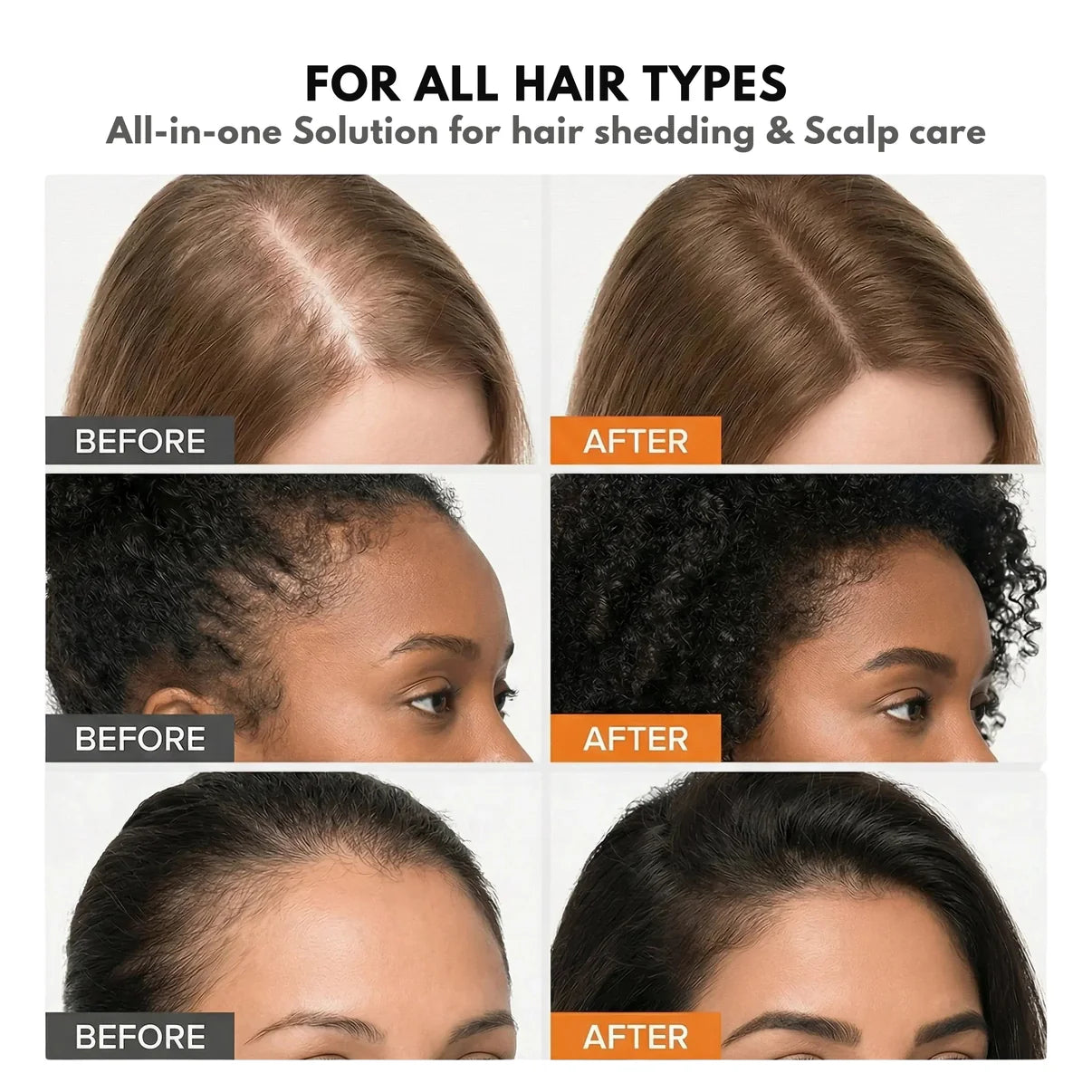 The Korea #1 Hair Density Serum